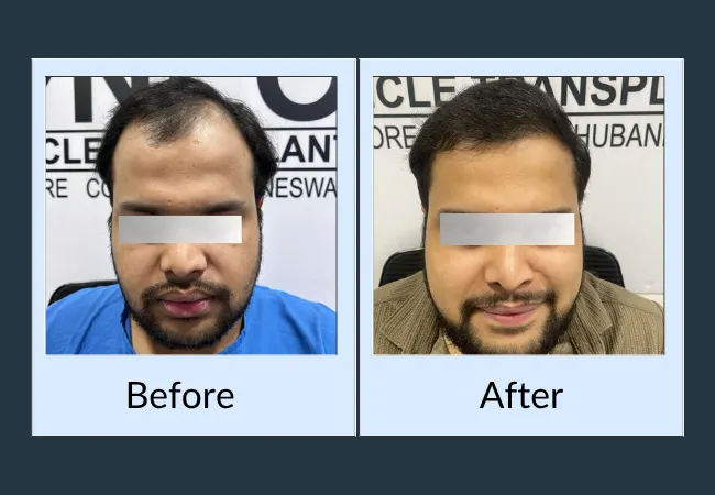 NFT Website Images Before After